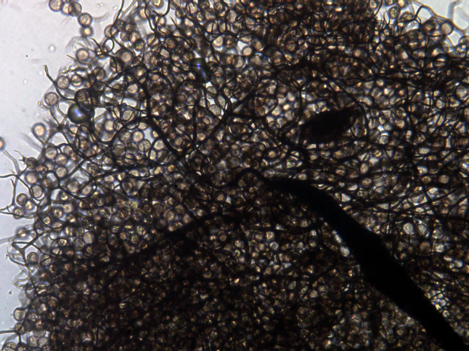 Microscopía de Stemonitis inconspicua - 10 - Apice columnela x 400
